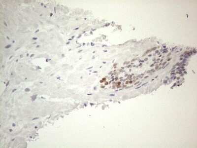Immunohistochemistry: GATA-3 Antibody (OTI8H4) - Azide and BSA Free [NBP2-70796]
