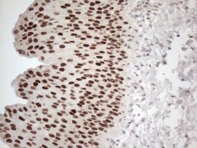 Immunohistochemistry: GATA-3 Antibody (OTI8H4) - Azide and BSA Free [NBP2-70796]