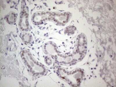 Immunohistochemistry: GATA-3 Antibody (OTI8H4) - Azide and BSA Free [NBP2-70796]