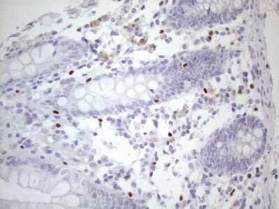 Immunohistochemistry: GATA-3 Antibody (OTI8H4) - Azide and BSA Free [NBP2-70796]