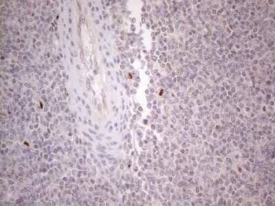 Immunohistochemistry: GATA-3 Antibody (OTI8H4) - Azide and BSA Free [NBP2-70796]