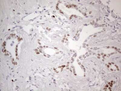 Immunohistochemistry: GATA-3 Antibody (OTI8H4) - Azide and BSA Free [NBP2-70796]