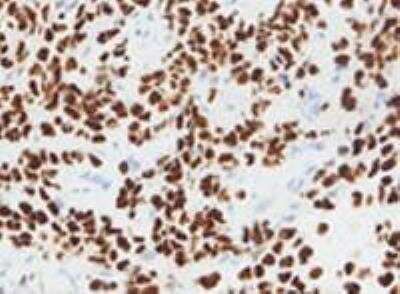 Immunohistochemistry-Paraffin: GATA-3 Antibody (OTI8H4) [NBP2-45810]