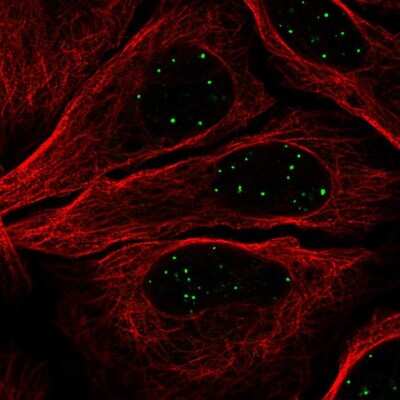 Immunocytochemistry/ Immunofluorescence: GATA-4 Antibody [NBP2-56566]