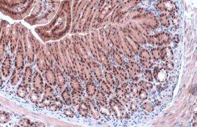 Immunohistochemistry-Paraffin: GATA-4 Antibody [NBP2-16613]
