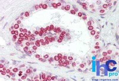 Immunohistochemistry-Paraffin: GATA-4 Antibody - BSA Free [NBP2-24585]