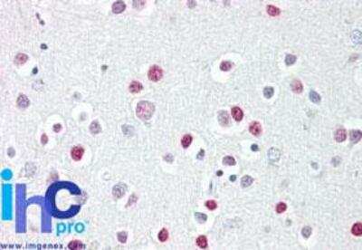 Immunohistochemistry-Paraffin: GATA-4 Antibody - BSA Free [NBP2-24585]