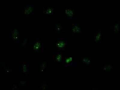 Immunocytochemistry/ Immunofluorescence: GATA-4 Antibody (OTI9F9) [NBP1-47765]