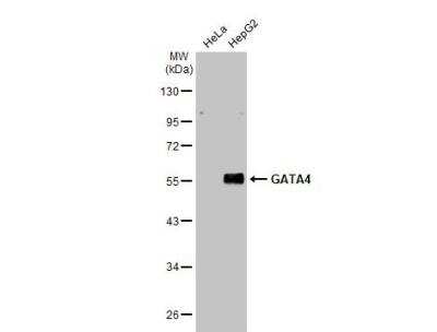 Western Blot: GATA-4 Antibody [NBP2-16613]