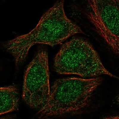 Immunocytochemistry/ Immunofluorescence: GATA-5 Antibody [NBP2-56593]