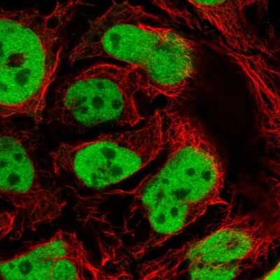 Immunocytochemistry/ Immunofluorescence: GATA-6 Antibody [NBP2-55937]