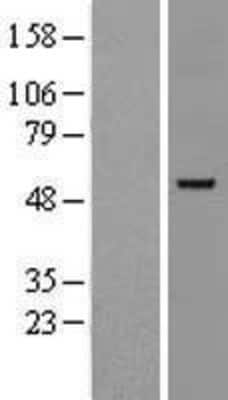 Western Blot: GATA-2 Overexpression Lysate [NBL1-10980]