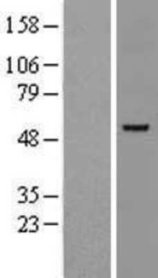 Western Blot: GATA-2 Overexpression Lysate [NBP2-09756]