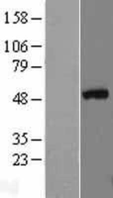 Western Blot: GATA-3 Overexpression Lysate [NBL1-10982]