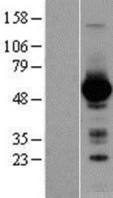 Western Blot: GATA-4 Overexpression Lysate [NBL1-10983]