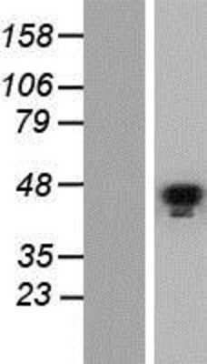 Western Blot: GATA-5 Overexpression Lysate [NBP2-05783]