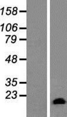 Western Blot: GATC Overexpression Lysate [NBP2-05015]