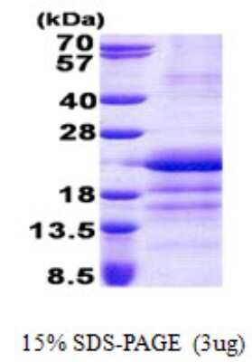 SDS-PAGE: Recombinant Human GATC His Protein [NBP2-23079]