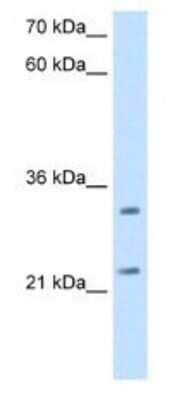 Western Blot: GATD3A Antibody [NBP1-80552]