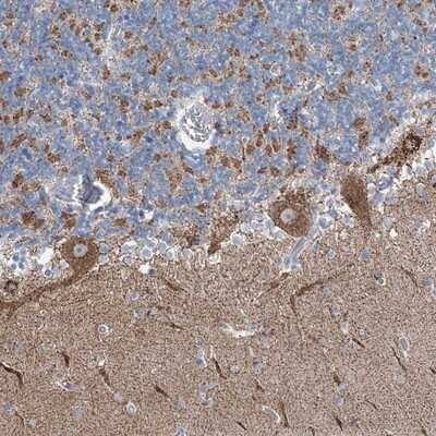 Immunohistochemistry-Paraffin: GATE-16/GABARAPL2 Antibody [NBP1-88883]