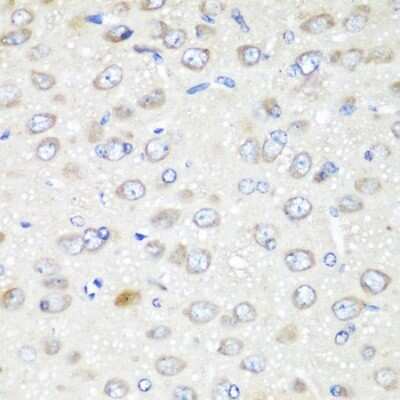 Immunohistochemistry-Paraffin: GATE-16/GABARAPL2 Antibody - BSA Free [NBP3-03245]