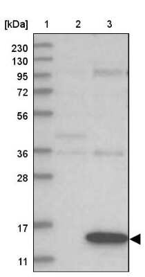 Western Blot: GATE-16/GABARAPL2 Antibody [NBP1-88883]