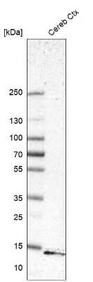 Western Blot: GATE-16/GABARAPL2 Antibody [NBP1-88883]