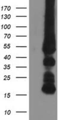 Western Blot: GATM Antibody (OTI1E3) [NBP2-00984]