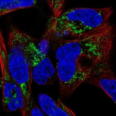Immunocytochemistry/ Immunofluorescence: GATM Antibody [NBP1-89211]