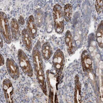 Immunohistochemistry-Paraffin: GATM Antibody [NBP1-89211]