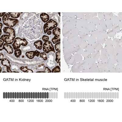 Immunohistochemistry-Paraffin: GATM Antibody [NBP1-89211]