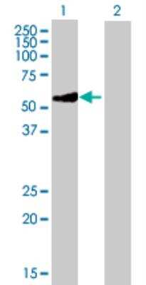 Western Blot: GATM Antibody [H00002628-B01P]
