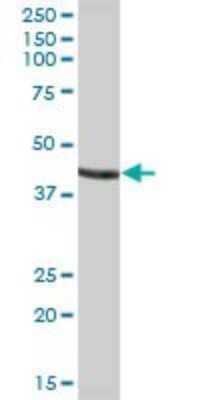 Western Blot: GATM Antibody [H00002628-B01P]