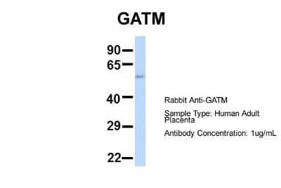 Western Blot: GATM Antibody [NBP1-54764]