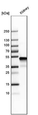Western Blot: GATM Antibody [NBP1-89211]