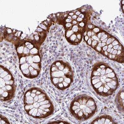 Immunohistochemistry-Paraffin: GATSL2 Antibody [NBP2-46838]