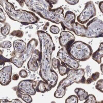 Immunohistochemistry-Paraffin: GATSL3 Antibody [NBP3-17496]
