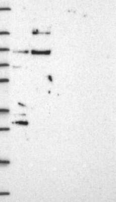 Western Blot: GATSL3 Antibody [NBP3-17496]