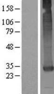 Western Blot: GATSL3 Overexpression Lysate [NBL1-12624]