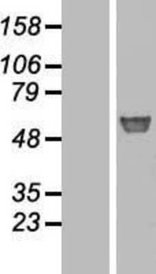 Western Blot: Glucosylceramidase/GBA Overexpression Lysate [NBL1-10990]