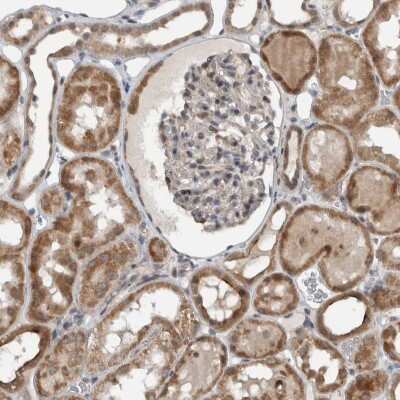 Immunohistochemistry-Paraffin: GBA2 Antibody [NBP1-89251]