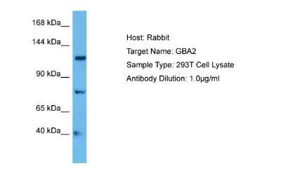 Western Blot: GBA2 Antibody [NBP2-84956]