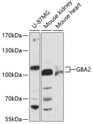 Western Blot: GBA2 AntibodyAzide and BSA Free [NBP3-05149]