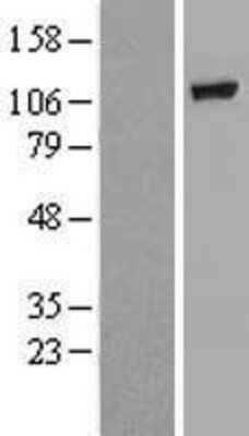 Western Blot: GBA2 Overexpression Lysate [NBL1-10991]