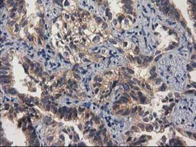 Immunohistochemistry-Paraffin: Cytosolic beta-Glucosidase/GBA3 Antibody (OTI1F1) [NBP2-00521]