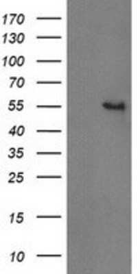 Western Blot: Cytosolic beta-Glucosidase/GBA3 Antibody (OTI1F1) [NBP2-00521]