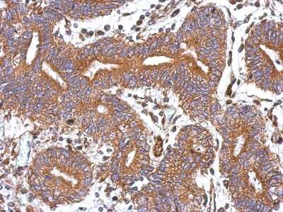 Immunohistochemistry-Paraffin: GBAS Antibody [NBP2-16617]