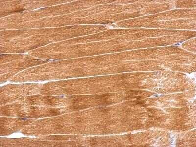 Immunohistochemistry-Paraffin: GBAS Antibody [NBP2-16617]