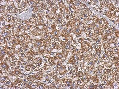 Immunohistochemistry-Paraffin: GBAS Antibody [NBP2-16618]