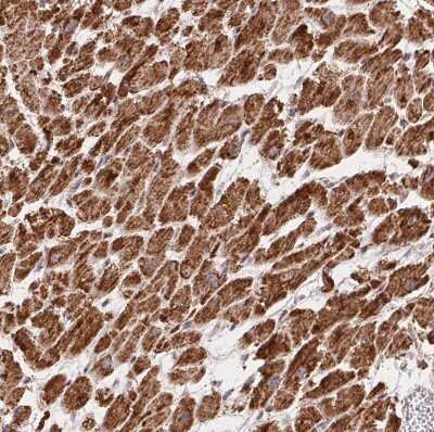 Immunohistochemistry-Paraffin: GBAS Antibody [NBP2-38984]